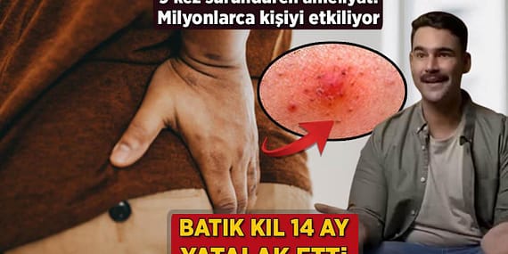 iceri-batan-kil-14-ay-yatalak-etti-9-defa-surunduren-ameliyat-milyonlari-etkiliyor-lq7CulIc.jpg